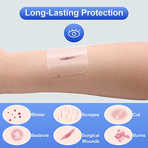 hydrocolloid Bandages