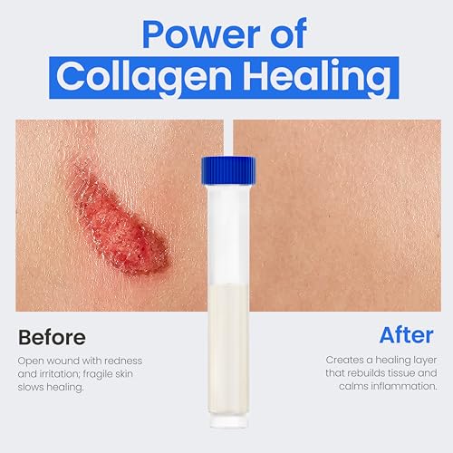 Collagen Dressing