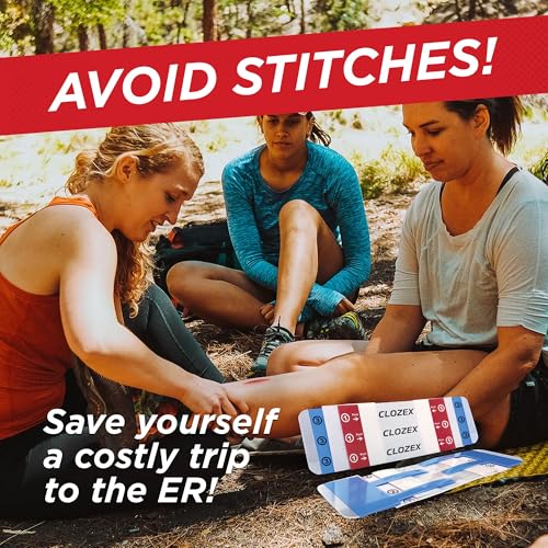 Emergency Laceration Closures