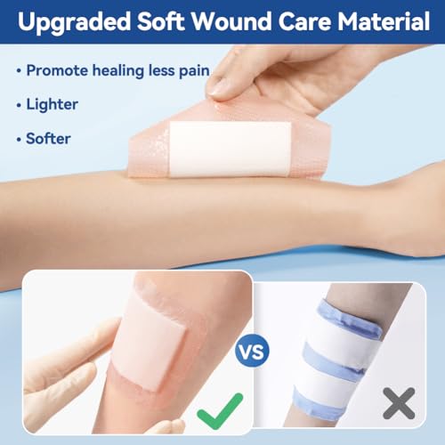 Super Absorbent Dressings