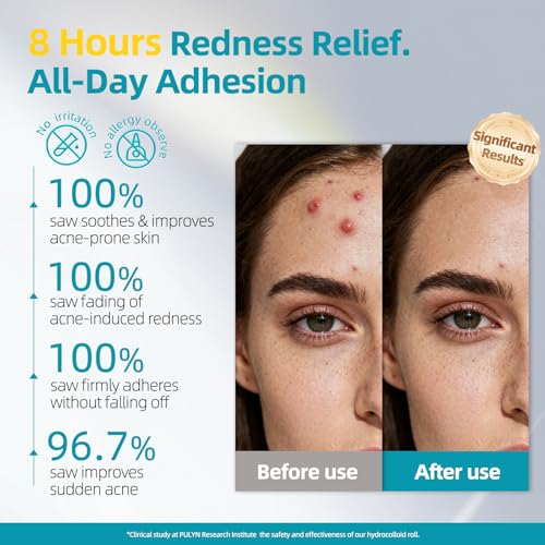 Hydrocolloid Wound Dressing…