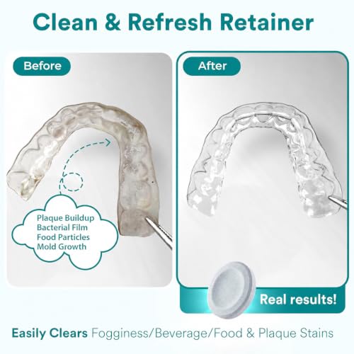 Denture and Retainer cleaning tablets Mint scented