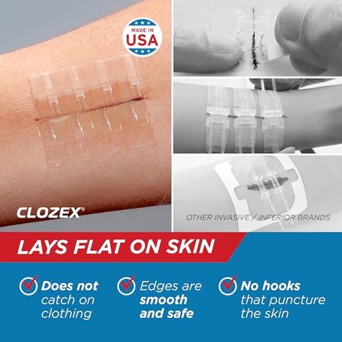 Emergency Laceration Closures