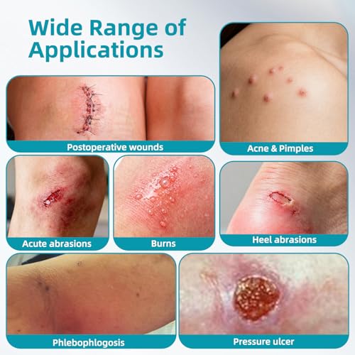 Hydrocolloid Wound Dressing…