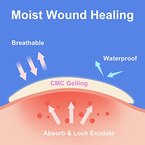 hydrocolloid Bandages