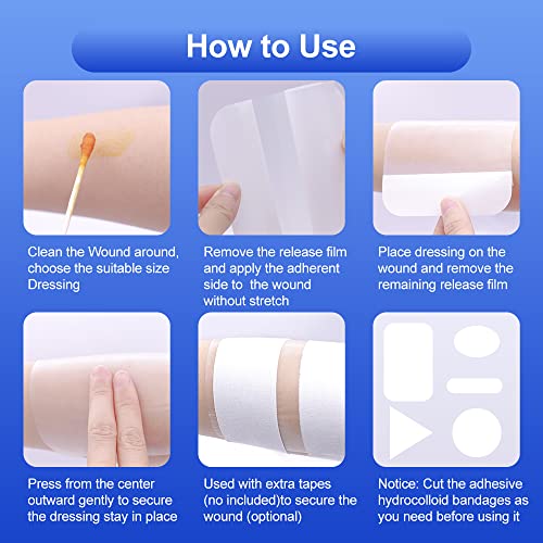 hydrocolloid Bandages