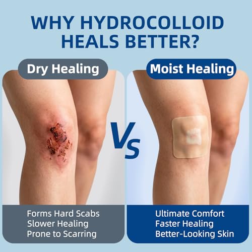 hydrocolloid Bandages
