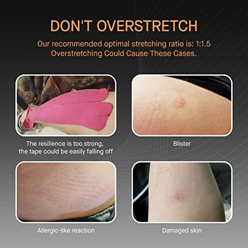 Kinesiology Tape