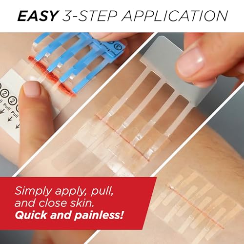Emergency Laceration Closures