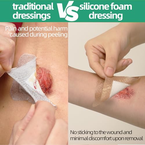 Wound Care Dressing