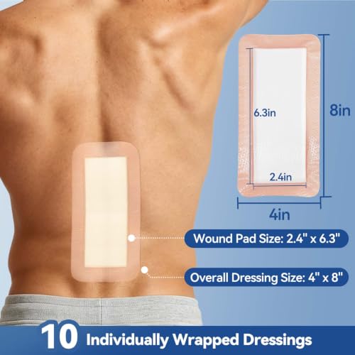 Super Absorbent Dressings